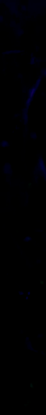 3971753240418307395-3_part_01.gif